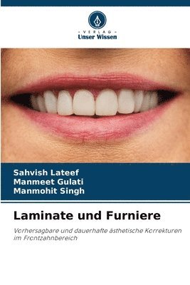 Sahvish LaTeef, Manmeet Gulati, Manmohit Singh - Laminate und Furniere, Häftad
