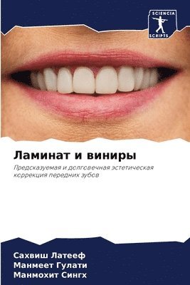 Сахвиш Латееф, Манмеет Гулати, Манмохит Сингх - Ламинат и виниры, Häftad