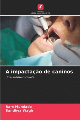 Ram Mundada, Sandhya Wagh - A impactação de caninos, Häftad