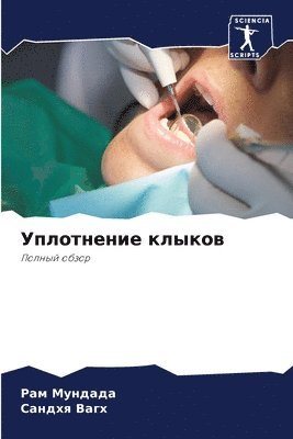 &#1059;&#1087;&#1083;&#1086;&#1090;&#1085;&#1077;&#1085;&#1080;&#1077; &#1082;&#1083;&#1099;&#1082;&#1086;&#1074; 1