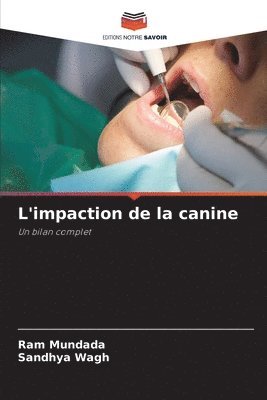Ram Mundada, Sandhya Wagh - L'impaction de la canine, Häftad