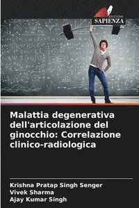 bokomslag Malattia degenerativa dell'articolazione del ginocchio