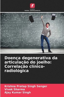 Doena degenerativa da articulao do joelho 1