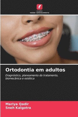 Ortodontia em adultos 1