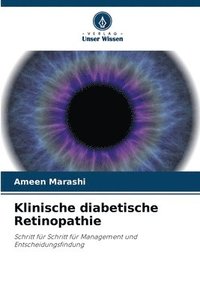 bokomslag Klinische diabetische Retinopathie