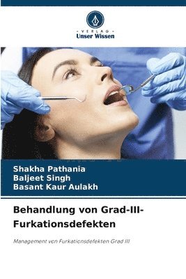 Shakha Pathania, Baljeet Singh, Basant Kaur Aulakh - Behandlung von Grad-III-Furkationsdefekten, Häftad
