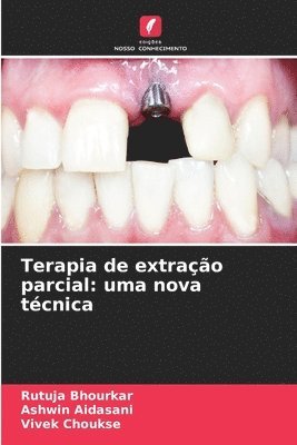 Terapia de extrao parcial 1