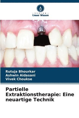 Rutuja Bhourkar, Ashwin Aidasani, Vivek Choukse - Partielle Extraktionstherapie, Häftad