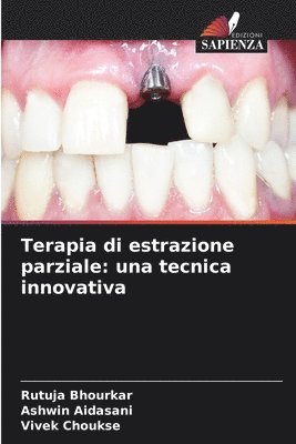 bokomslag Terapia di estrazione parziale