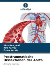 bokomslag Posttraumatische Dissektionen der Aorta