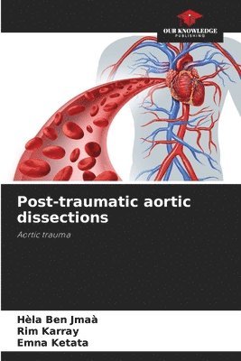 Hèla Ben Jmaà, Rim Karray, Emna Ketata - Post-traumatic aortic dissections, Häftad
