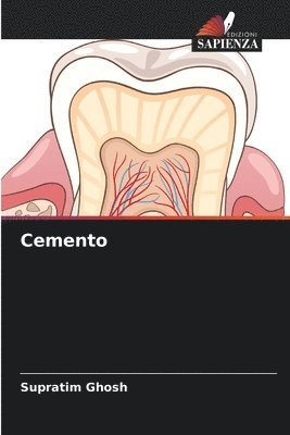 Cemento 1