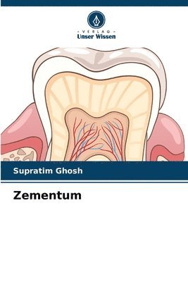 Zementum 1