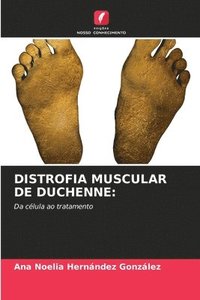 bokomslag Distrofia Muscular de Duchenne