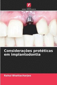 bokomslag Considerações protéticas em implantodontia