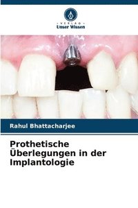 bokomslag Prothetische berlegungen in der Implantologie