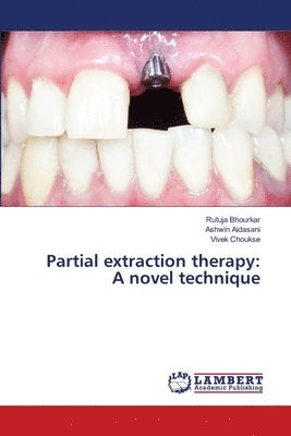 Rutuja Bhourkar, Ashwin Aidasani, Vivek Choukse - Partial extraction therapy, Häftad