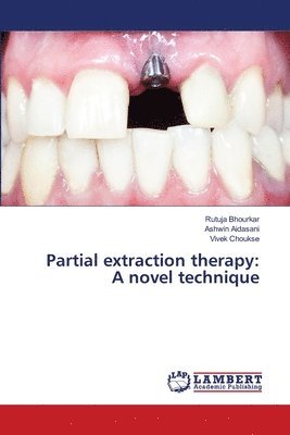 Partial extraction therapy 1