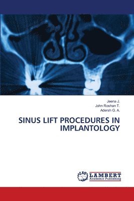 bokomslag Sinus Lift Procedures in Implantology