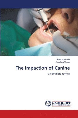 Ram Mundada, Sandhya Wagh - Impaction of Canine, Häftad