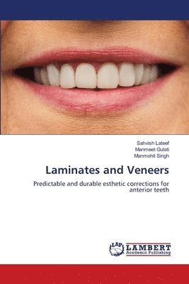 Sahvish LaTeef, Manmeet Gulati, Manmohit Singh - Laminates and Veneers, Häftad