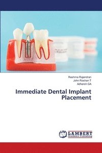 bokomslag Immediate Dental Implant Placement