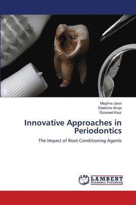 Meghna Jassi, Deeksha Ahuja, Gurpreet Kaur - Innovative Approaches in Periodontics, Häftad