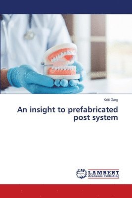 An insight to prefabricated post system 1