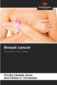 bokomslag Breast cancer