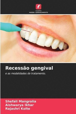 bokomslag Recessão gengival