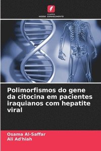 bokomslag Polimorfismos do gene da citocina em pacientes iraquianos com hepatite viral