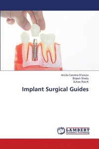 bokomslag Implant Surgical Guides