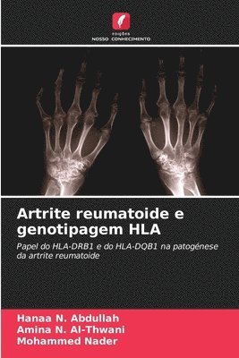 Artrite reumatoide e genotipagem HLA 1