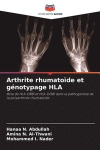 bokomslag Arthrite rhumatode et gnotypage HLA