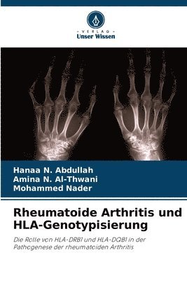 Rheumatoide Arthritis und HLA-Genotypisierung 1