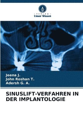 bokomslag Sinuslift-Verfahren in Der Implantologie