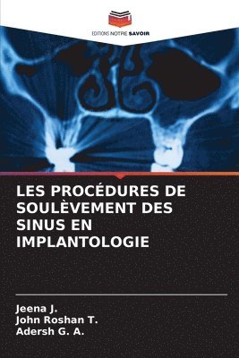 Jeena J, John Roshan T, Adersh G a, John Roshan T., Jeena J., Adersh G. A. - Les Procédures de Soulèvement Des Sinus En Implantologie, Häftad