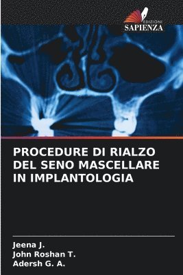 bokomslag Procedure Di Rialzo del Seno Mascellare in Implantologia