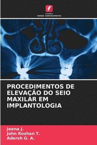 bokomslag Procedimentos de Elevao Do Seio Maxilar Em Implantologia