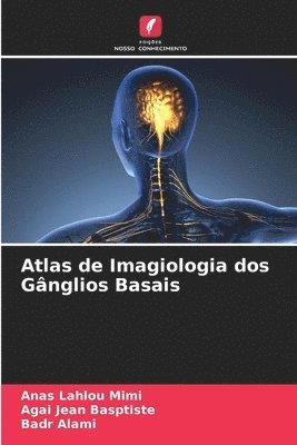 Anas Lahlou Mimi, Agai Jean Basptiste, Badr Alami, Agai jean basptiste - Atlas de Imagiologia dos Gânglios Basais, Häftad