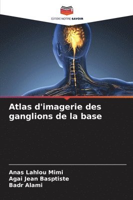 bokomslag Atlas d'imagerie des ganglions de la base