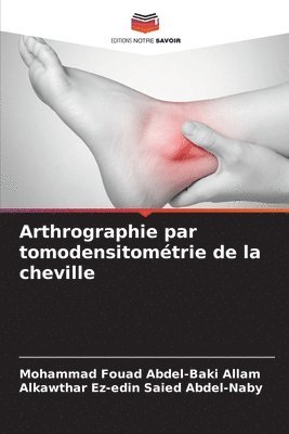 Arthrographie par tomodensitomtrie de la cheville 1