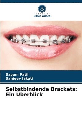 bokomslag Selbstbindende Brackets