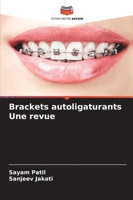 bokomslag Brackets autoligaturants Une revue