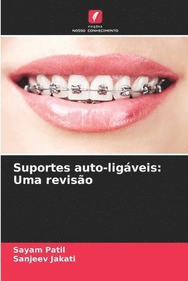 Suportes auto-ligveis 1