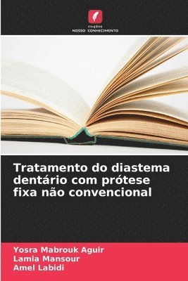 bokomslag Tratamento do diastema dentrio com prtese fixa no convencional