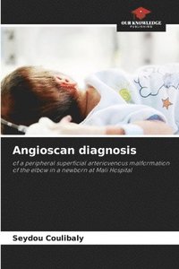 bokomslag Angioscan diagnosis