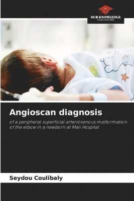 bokomslag Angioscan diagnosis