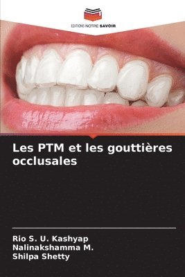 Les PTM et les gouttires occlusales 1