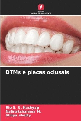DTMs e placas oclusais